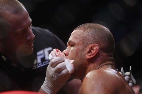 Pior Nariz Quebrado Do Ufc